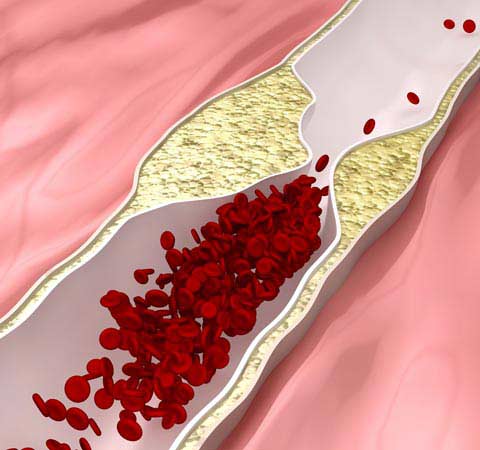 Homocystrol+TMG beneficios