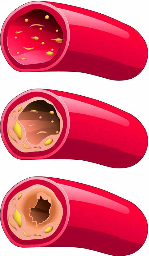 Active Cardisterol Salengei